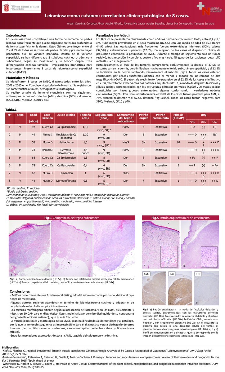 edusqo's tweet photo. "@SEAP_IAP: Arean C y col. #SEAP2016 #AnatomiaPatologica. #sarcoma https://t.co/w7dTsmtmat" Cutaneous Leiomyosarcoma @JMGardnerMD