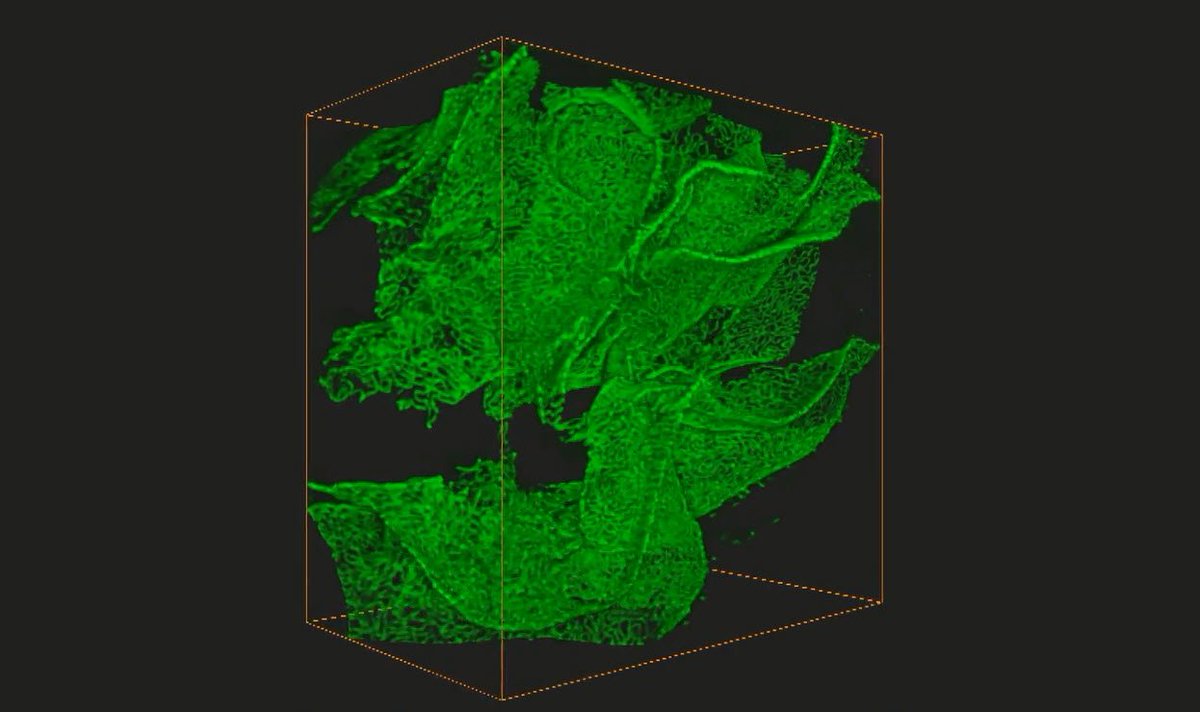 LeicaMicro's tweet image. New on #ScienceLab: #STED &amp;amp; CLARITY - #nanoscopy in optically cleared #kidney tissue bit.ly/23NoE7X