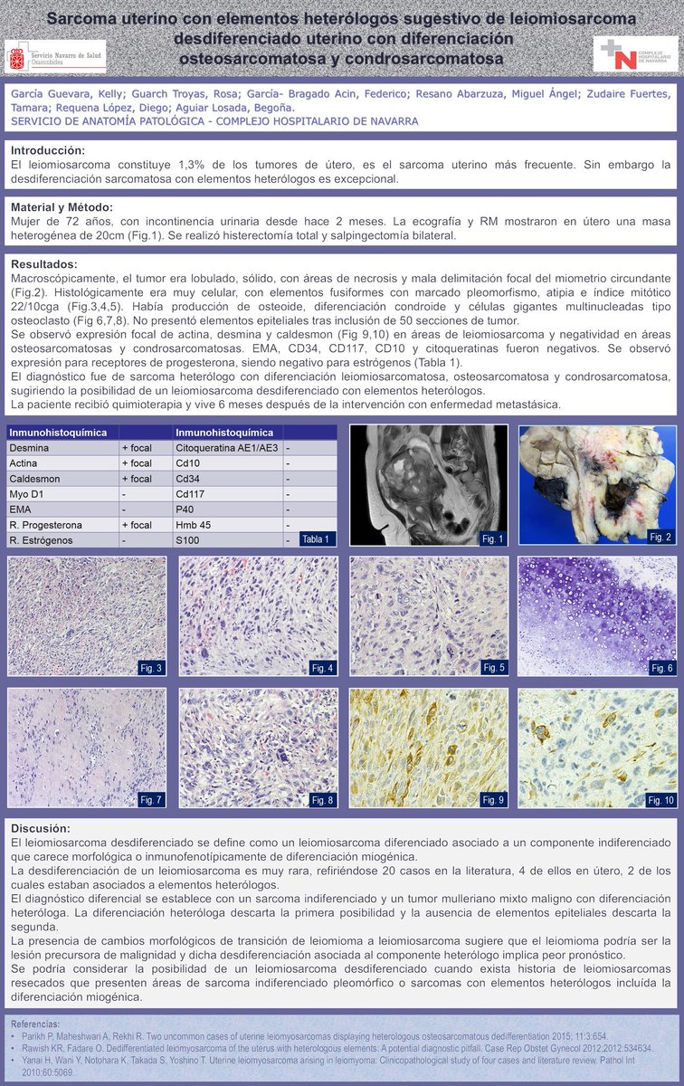 edusqo's tweet photo. "@SEAP_IAP: Garcia-Guevara K y col. Sesión pósteres. #SEAP2016. #sarcoma https://t.co/3ekIbfz6zB" Uterine #sarcoma @JMGardnerMD