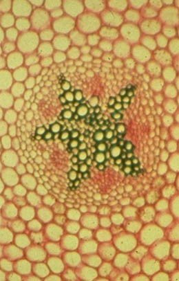 b_guilloux's tweet photo. Photo d’une coupe transversale de racine observée au microscope optique colorée  (X 400)
#FloraTS2015 #TPSève2015 https://t.co/XGZTx56ZdH