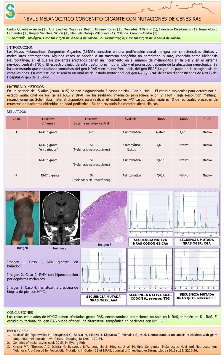 edusqo's tweet photo. "@SEAP_IAP: Quimbayo C y col. Sesión pósteres. #SEAP2016. #dermatopath https://t.co/uNV5wuFtI9" Congenital Nevus @JMGardnerMD