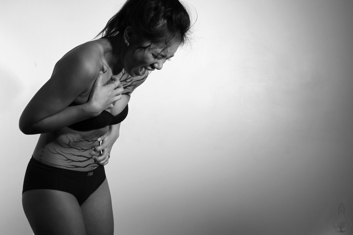 StampStigma's tweet image. What if #mentalillnesses were shown on the outside? buff.ly/1X5UmbL (ht @WeMustBeBroken)