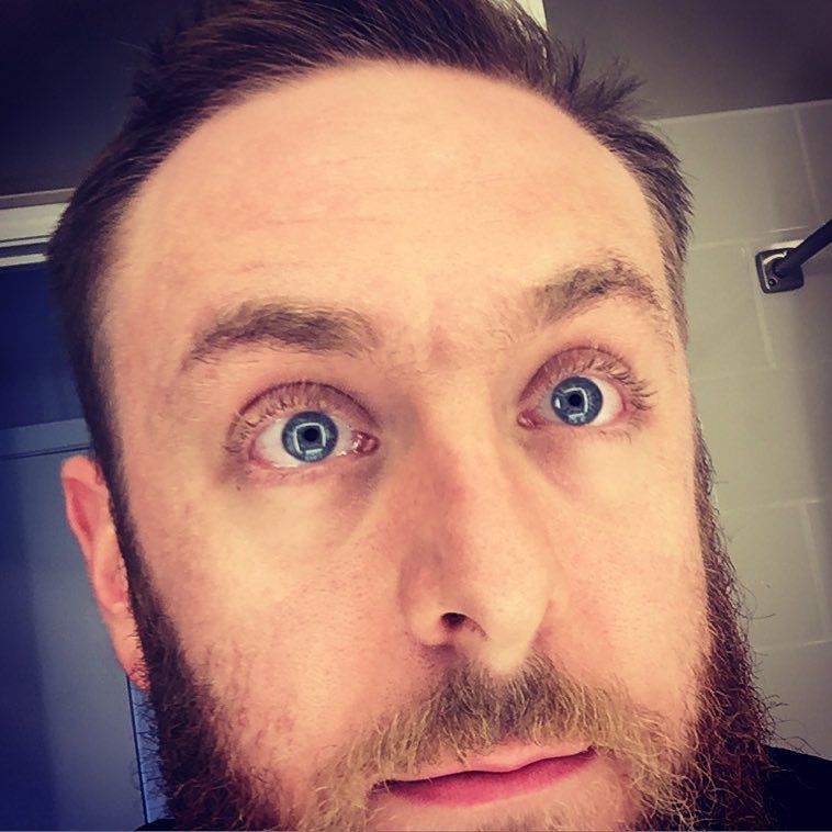 TJMRobertson's tweet image. Those eyeballs. #bathroomselfies #coollights ift.tt/1odCboR