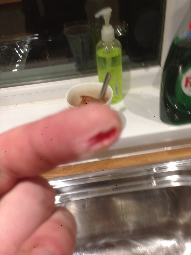 Think I cut myself at work
