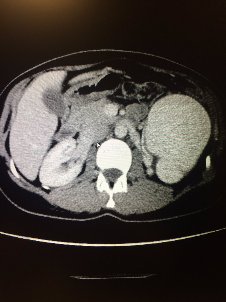 Lawrence Keating tweet media