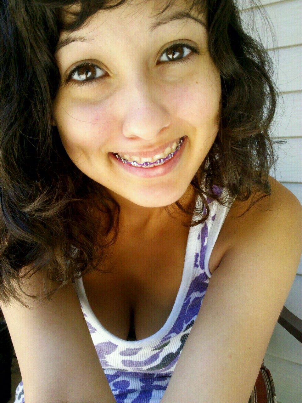 sexy teens braces 