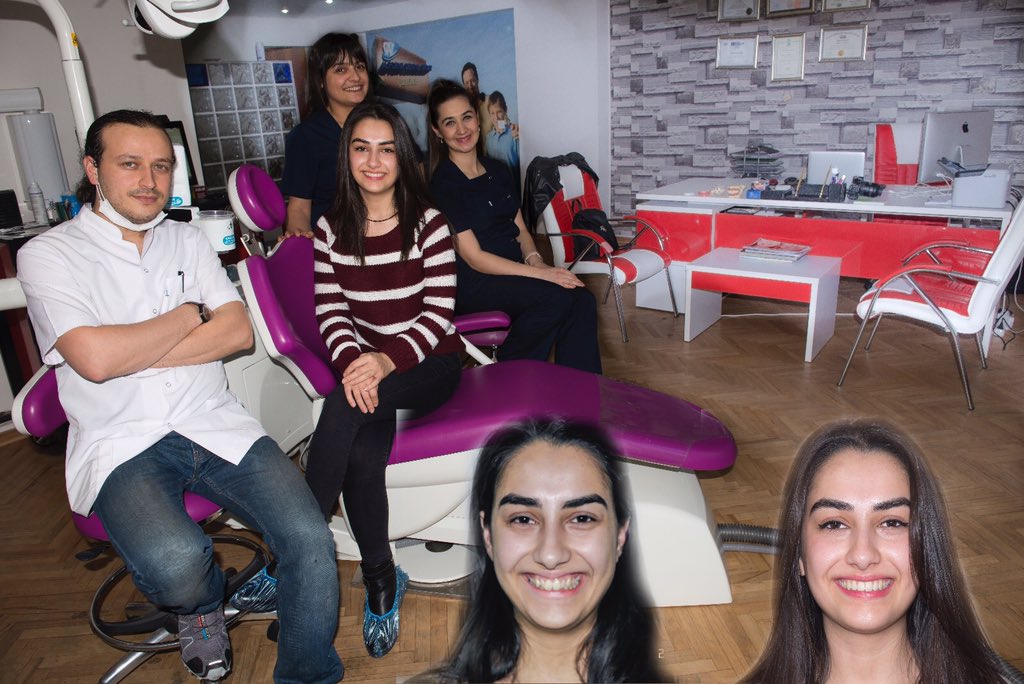 Öncesi ve 1 yıllık ortodonti tedavisi ile yaptığımız gülümseme tasarımı sonrası... alpdent.net