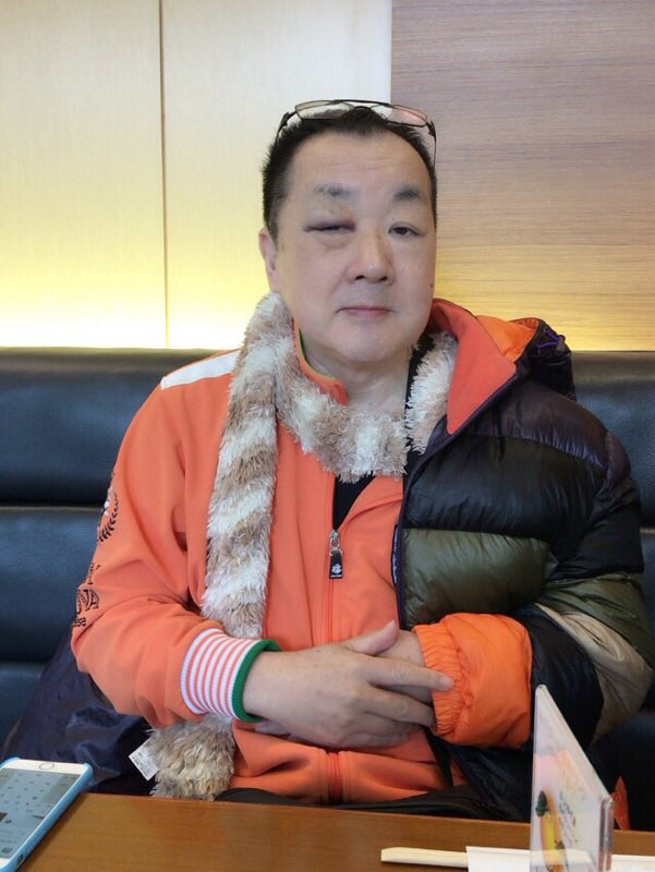 さくま あきら Aholy1112 いいえ 私はさそり座の女じゃないわよ