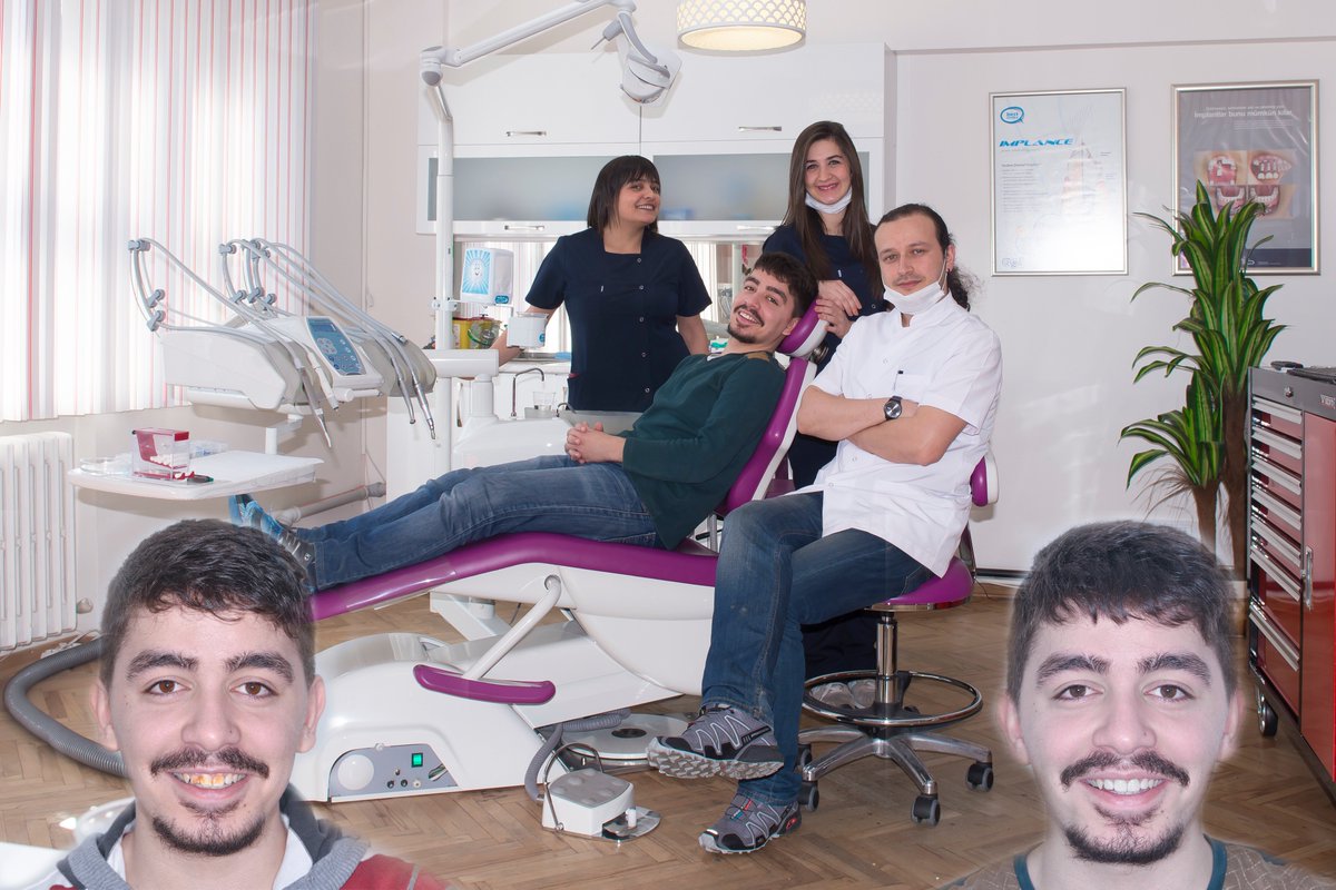 Lamiate kaplama uygulamasıylada 1 hafta gibi bir süre içerisinde rahatça gülümseyebilirsiniz
alpdent.com