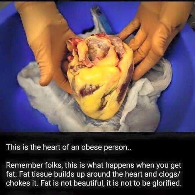 DailyGymSecrets's tweet photo. Fat is not beautiful. Stop telling people it's okay to be fat 🙊 https://t.co/yc5BcpaB81