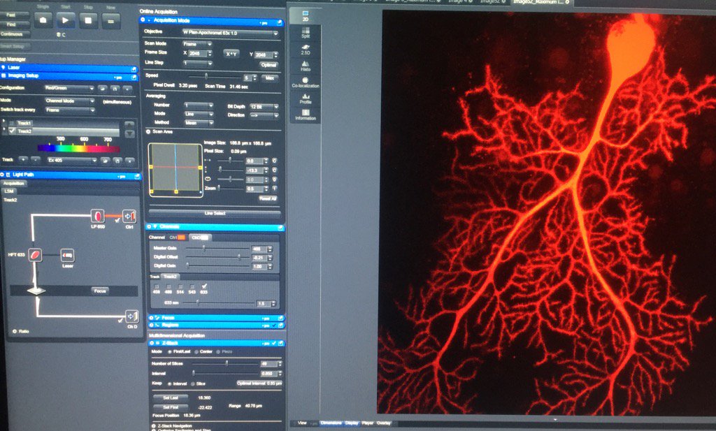 dhsimmons1's tweet photo. Doing another cool calcium imaging demo today in @UChicago's #HanselLab! #neuroscience #STEM @neuroMOOC @ScienceLife https://t.co/dLHNDIkFpH