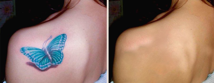 modsculpt's tweet photo. Fed up by old tattoo, wanna to remove it without pain, have a look at it https://t.co/TOwoLuMAyT
#Houston #Modsculpt https://t.co/59cJ808dBh