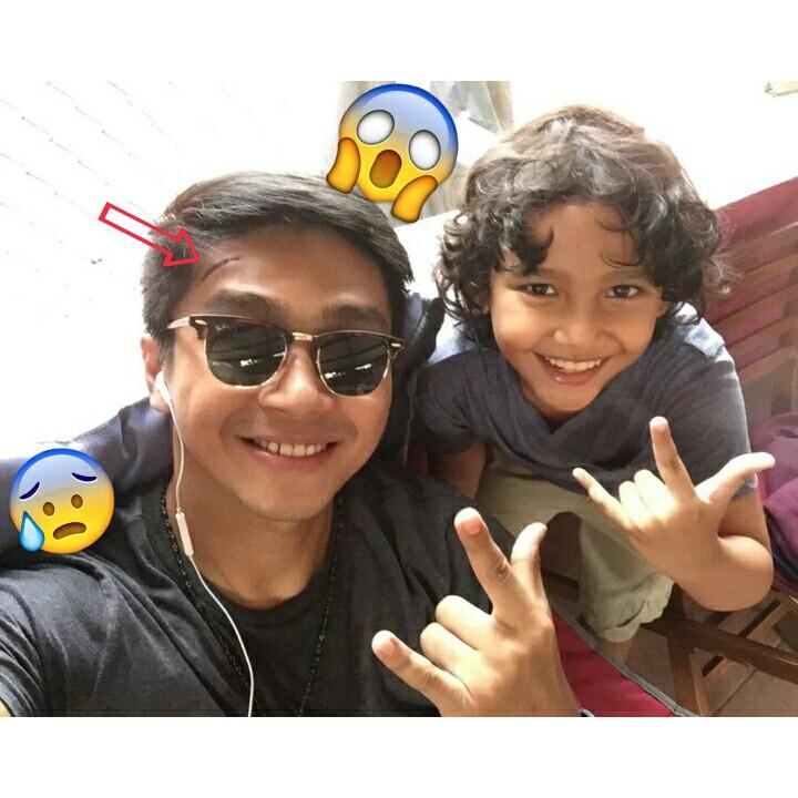 DevalovaMks_'s tweet photo. Jidat kenapa tuh bang? Tetap selalu jaga kondisi yah dan hati2 kalau lagi shooting.Kami selalu support &amp;mendoakanmu https://t.co/Wy485LSRvH