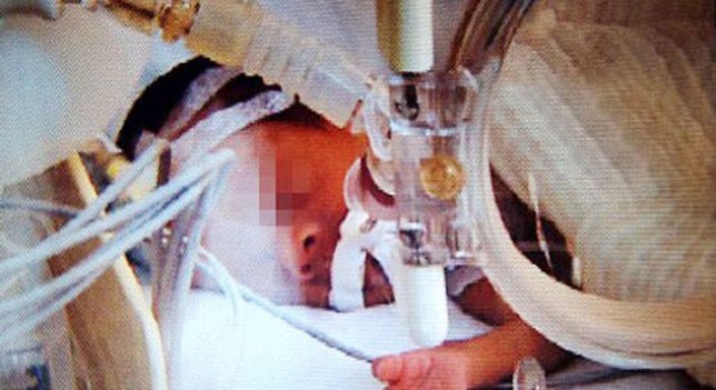 Un bebé chino despierta llorando justo antes de ser incinerado tras ser declarado muerto atres.red/0nm7q