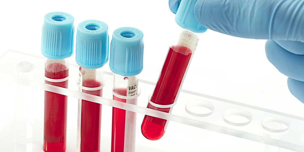 a_found_one's tweet photo. The blood test will be able to detect cancer early in five common cancers..

https://t.co/avig0uZAg2

#cancer https://t.co/Um5Duw38As