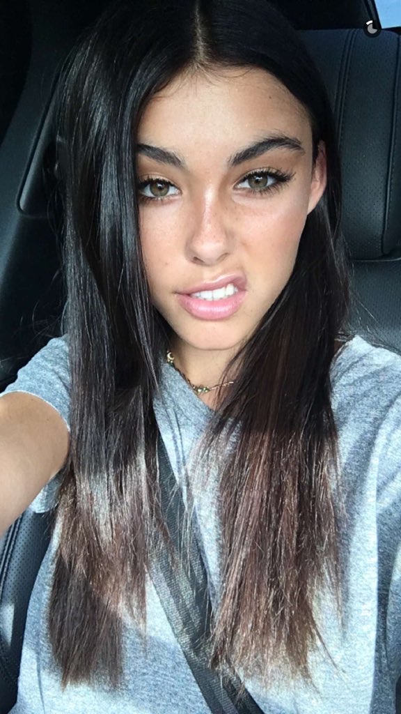 Freckles 😍