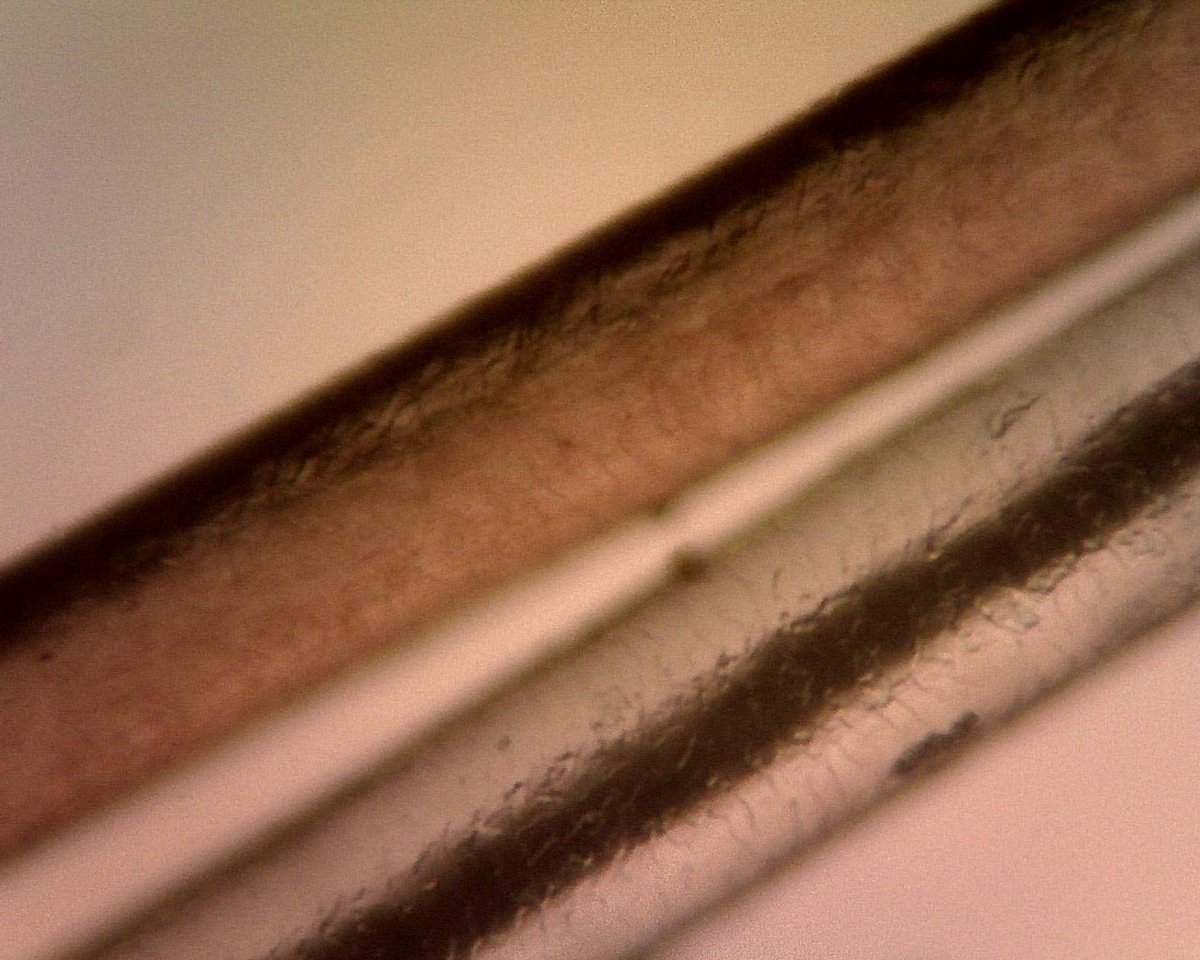 Natalie Panek On Twitter Comparison Of My White Hair Caused By