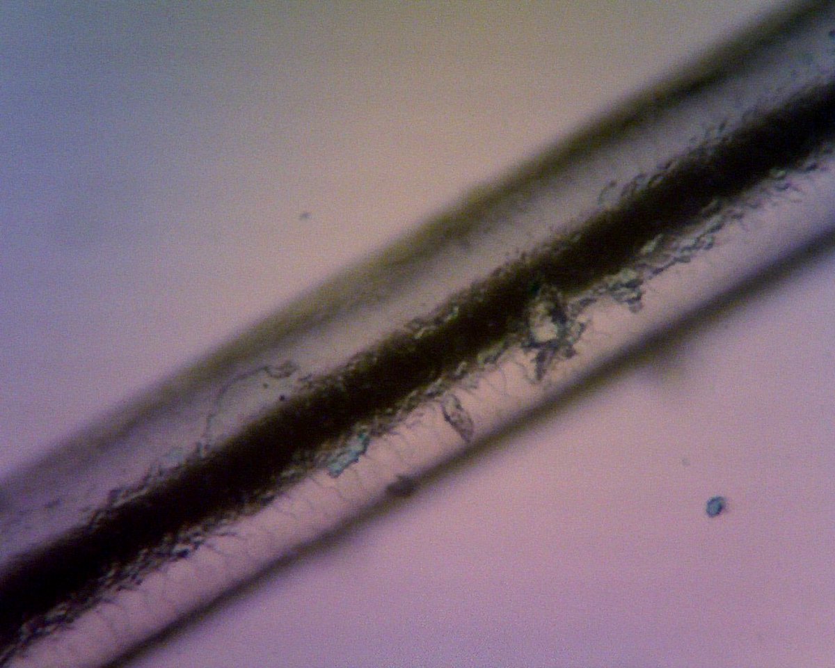 nmpanek's tweet photo. Comparison of my white hair, caused by Vitiligo, with the rest of my brown hair! #undermymicroscope #science https://t.co/NRLo86T230