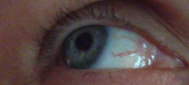 UberFacts's tweet photo. This woman has a blood vessel in her eye that seems to spell the word "love." https://t.co/8HDq5AhZjP