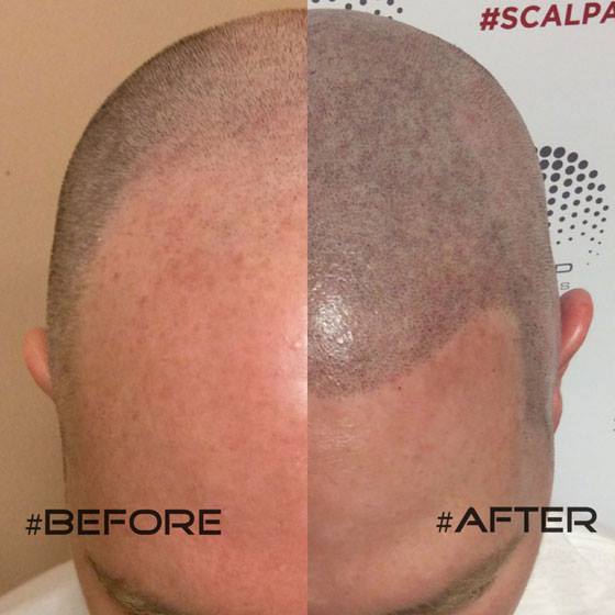 Скальп кожи головы. Скальп кожи головы. Скальп кожи головы. Трихопигментация головы. Стянутость кожи головы.