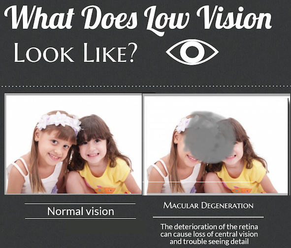 OpticalEdgeTX's tweet photo. Wondering what low vision looks like? Check out the image below! https://t.co/5fUO5qGlRF