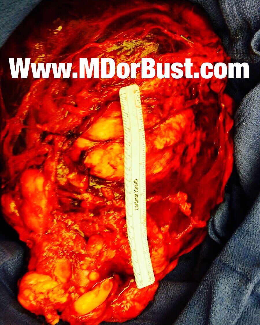 MDorBust tweet media