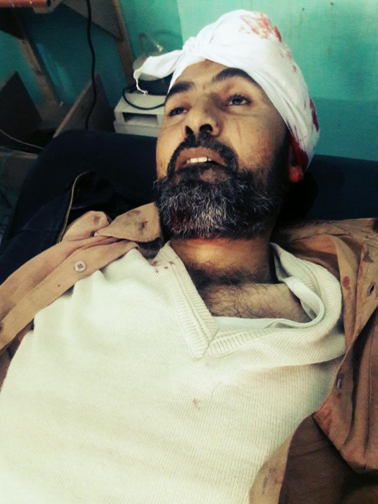 Mostafa0988198's tweet photo. الشهيد بإذن الله تعالى  مهند جمعة  قتل  قنصا وهو مدني على أيدي #أهل_البغي_والضلال 
في #مدينة_الضمير 
#داعش https://t.co/4DiclSdpBn