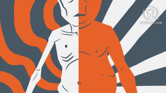 MovePH's tweet image. PH fails to halve child malnutrition within 25 years s.rplr.co/GLMDZTU #HungerProject