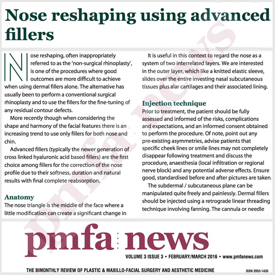 PMFAJournal's tweet image. How to reshape the #nose using #advancedfillers on.fb.me/1Q93dUs #aesthetics #cosmeticsurgery