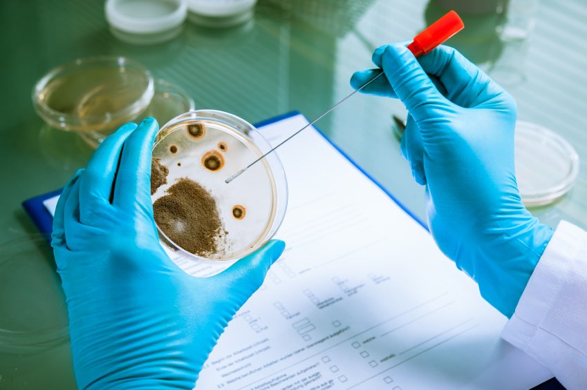 aapscanada's tweet photo. Want a #foodqualitycontrol career? A basic understanding of #microbiology is essential https://t.co/QaduTW0UJQ https://t.co/epapQu8IoQ
