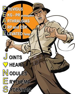 imindmaps's tweet image. Diagnosis of rheumatic heart disease needs 2 major or 2 menor + 1 major JONES criteria #USMLE #meded #Step1 #Step2