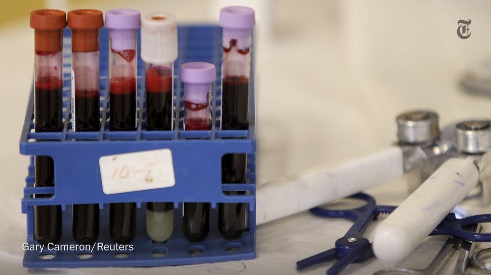 NYTHealth's tweet image. Different drops of blood from single fingerpricks can produce very different test results nyti.ms/1QBIi2N