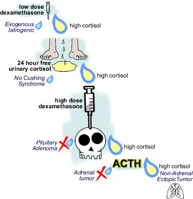 imindmaps's tweet image. Dexamethasone suppression test #USMLE #Step1 #Step2 #Step3 #Meded #mindmaps