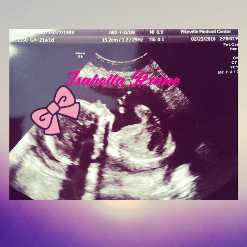 Brandi_Hager's tweet image. #IsabellaRaine #21weeksand1day #anatomyscan #perfect 💕💕💕💕