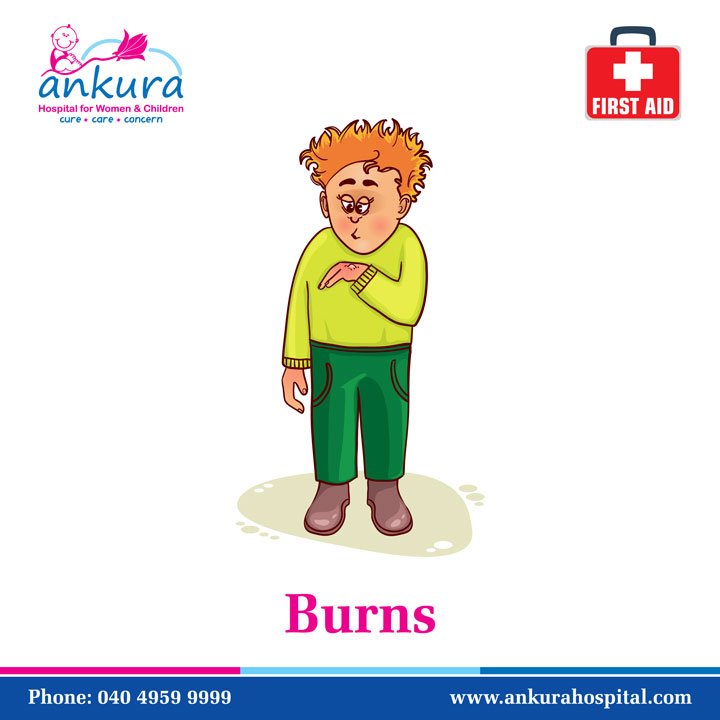 johnkellygreen4's tweet photo. RT https://t.co/NZQuJstZCJ First Aid: Burns: https://t.co/QjyS7vtXnp
#Burns #BurnsFirstAid
#FirstAid #FirstAidT… https://t.co/ZWXWy34Lfi