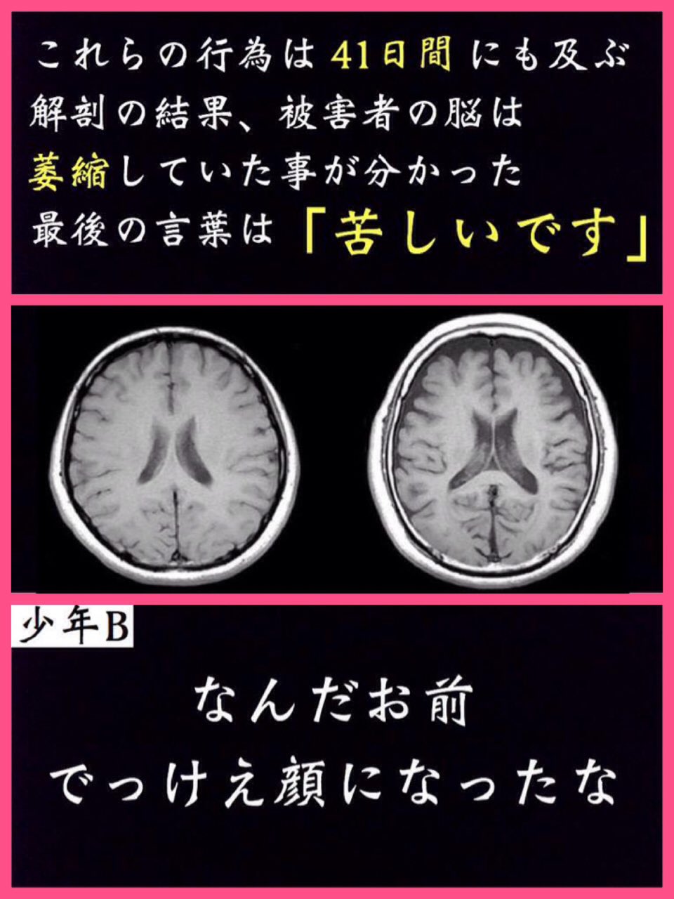 Shhh 女子高生コンクリート殺人事件 19年 バイト帰りの女子高生に少年aが親切な素振りで近づいた 略取 誘拐 監禁 強姦 暴行 殺人 死体遺棄 狂宴犯罪 これでも死刑にならない 女子高生はいつもと同じ 帰宅途中だった T Co 7wb8opptpv