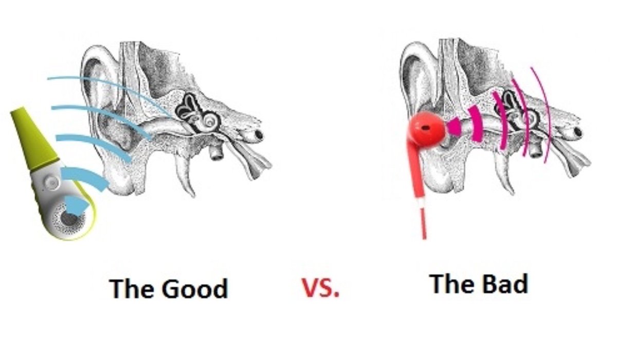 myMusicWrap's tweet photo. Earbuds are damaging our kids eardrums. It’s not just what they listen to, but how. #health
https://t.co/dH0xd48Mxl https://t.co/TpWUYlEEFh
