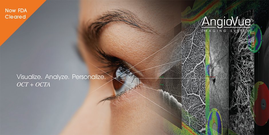 Optovue’s AngioVue Imaging System Receives FDA Clearance. Read:  hubs.ly/H024XKk0 #OCTA #yourOCTspecialist