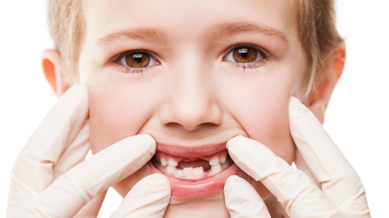 BioKidz's tweet photo. Stem Cells From Teeth Might Help Save Your Child's Life https://t.co/yuwrQwwaUG https://t.co/y2zTwQPBvg