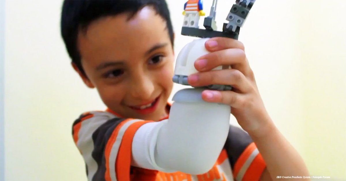 inhabitat's tweet photo. LEGO arm lets kids customize their own prosthetics
https://t.co/fFTOBOD1mX https://t.co/KDPTVaJWdz