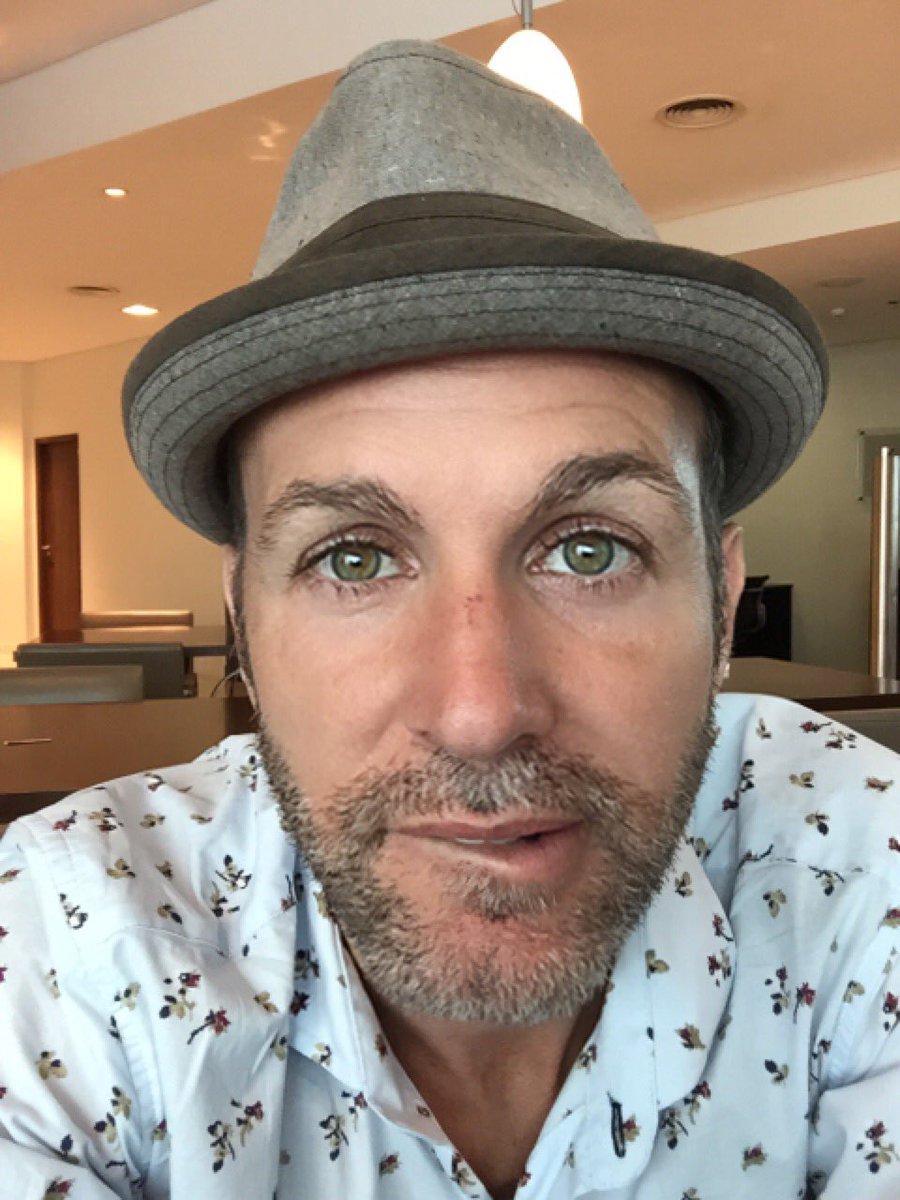 AxelOficial's tweet photo. Me están preguntando que me pasó en la nariz... 
Miren bien la foto q va encuesta 😜 https://t.co/D9KorvQ4ke