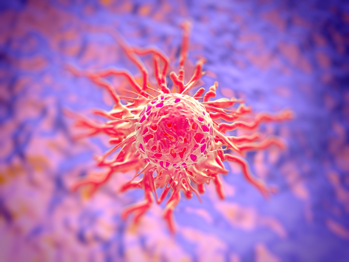OncLive's tweet photo. Dr. Gershenson on Evolution of Targeted Therapies for Rare Gynecologic Malignancies https://t.co/BP3rHYxcm4 #gynca https://t.co/RUHIEjkoK0