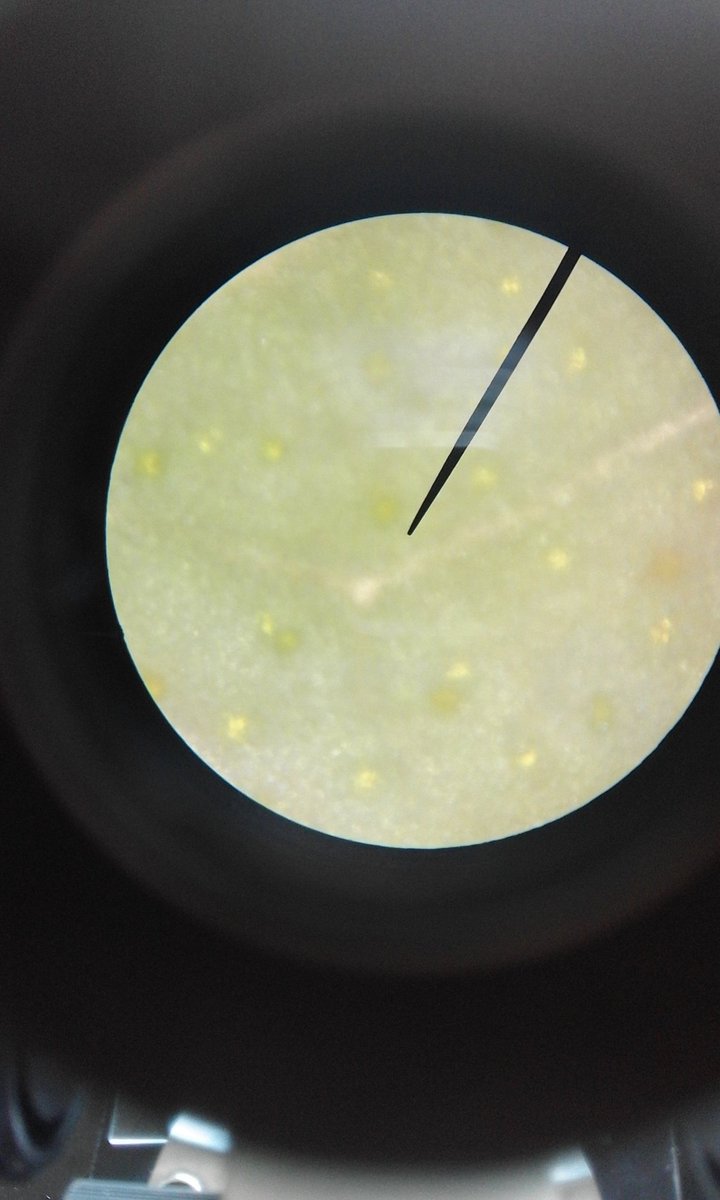 skyseverino_'s tweet photo. a strand of hair, leaf &amp; r own saliva from cheek lining with &amp; w/o iodine solution under Microscope!! 🔬 #ZoologyLab https://t.co/vbsS2qalQv