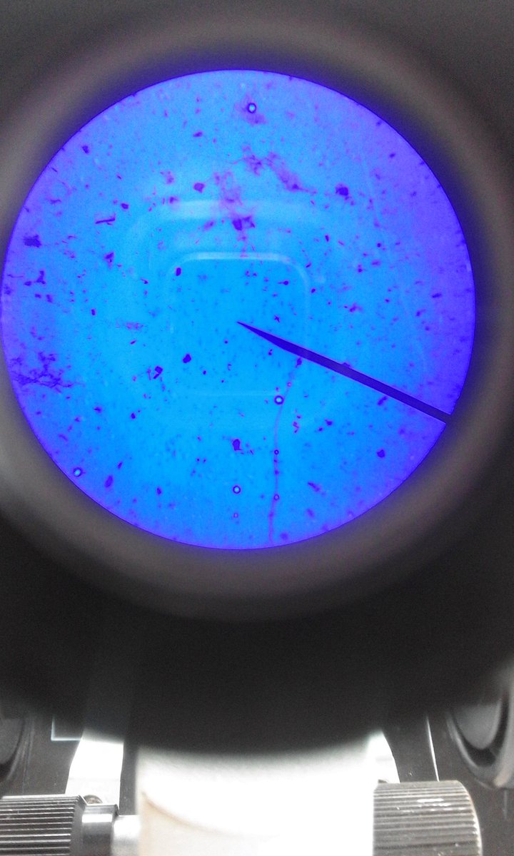 skyseverino_'s tweet photo. a strand of hair, leaf &amp; r own saliva from cheek lining with &amp; w/o iodine solution under Microscope!! 🔬 #ZoologyLab https://t.co/vbsS2qalQv