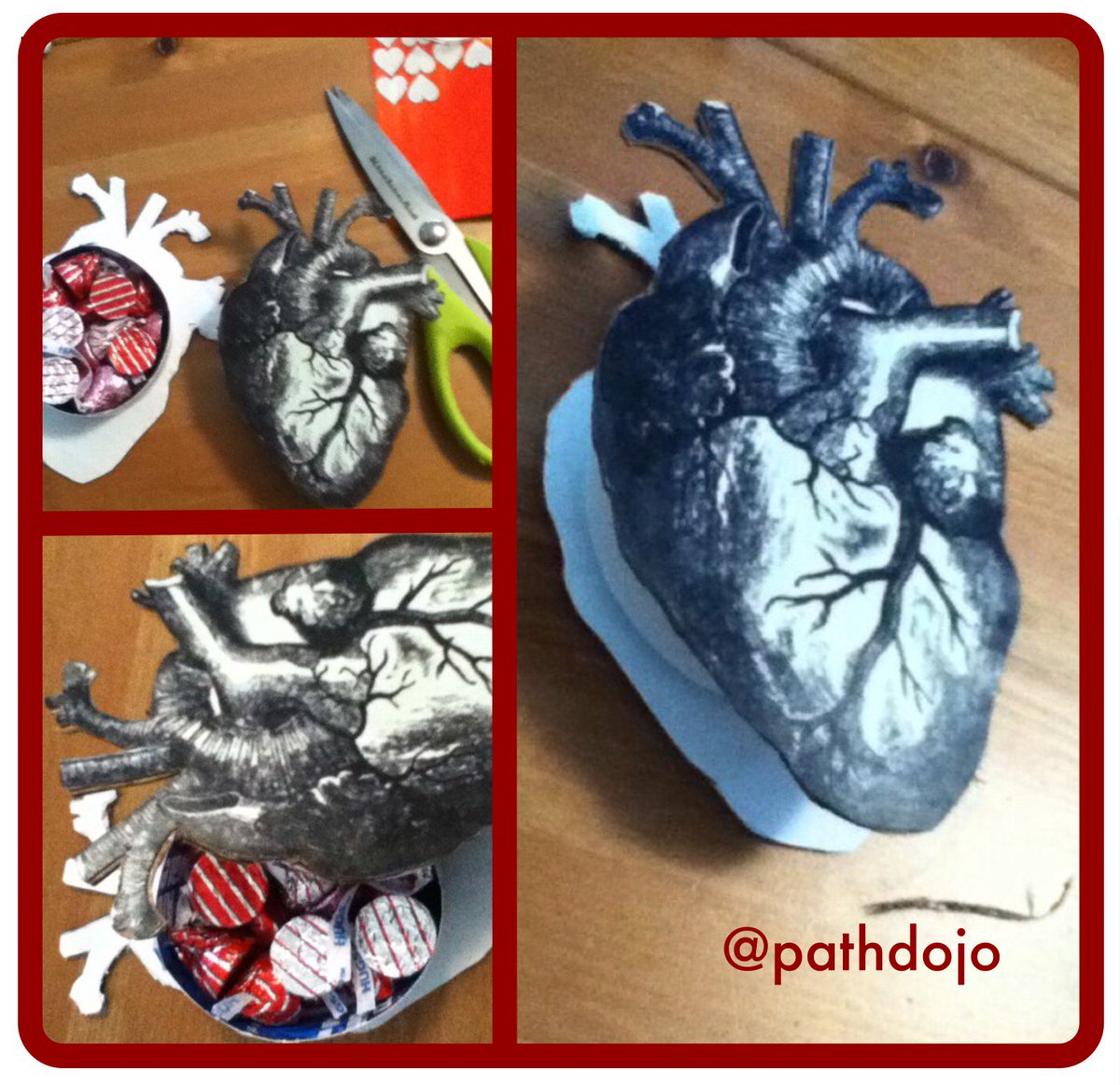 PathDojo's tweet photo. For your #pathologist valentine: a heart-shaped box filled with chocolate.  #ValentinesDay #pathology #PathArt https://t.co/2JUHlm8m2w
