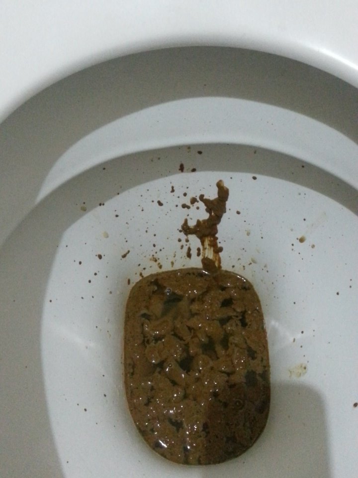 Hecesquiel Pe Twitter Artebreve Artecontemporaneo Art Johnnymaccaca Reportefecal Diarrea Shit Caca T Co Pytylmup9j Twitter