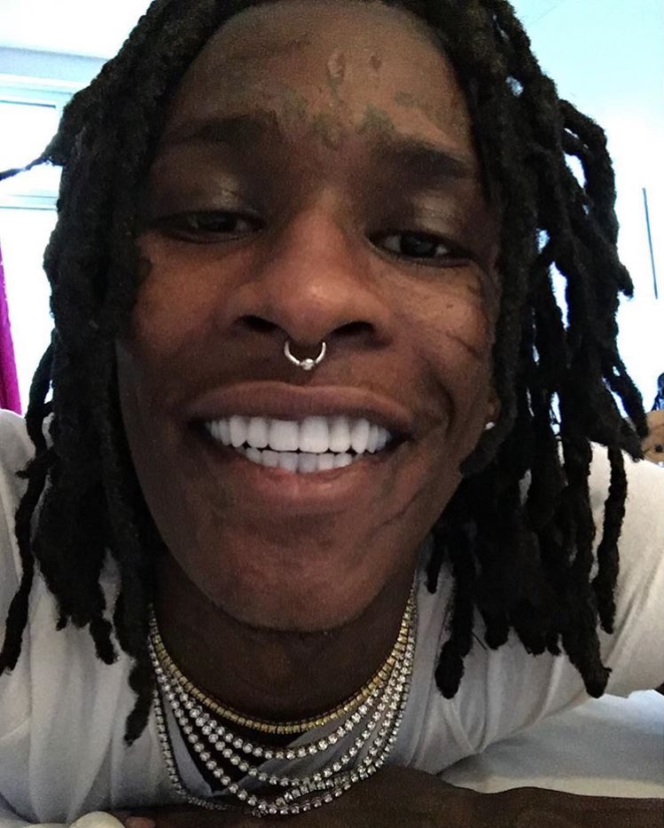 Young Thug Teeth