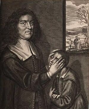 DMMacRaild's tweet photo. Born #otd #irishhistory 1618 Irish "Stroker", faith-healer, Valentine Greatrakes
#Scrofula
https://t.co/qwkgMaTu3r https://t.co/pdlShWys2f