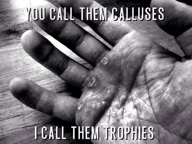 MansaMoussaa's tweet photo. Tu les appelles des cloques, j'appelle ça des trophées ! #muscu #calluses #cloques #halteres #workout #gym #sport https://t.co/P5XOypTmWL