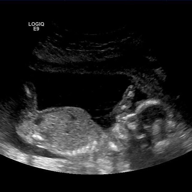 instachef_Au's tweet photo. bun#3 is in the oven! 
Halfway today! 🍼
Have a #guess #Girl💜 or #Boy💙
#dadlife #baby #chefskid #kids https://t.co/6B9QI8PY9B